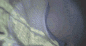p250845adabf645676e