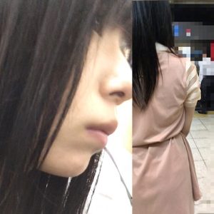 p428825bbe24c49fbb9