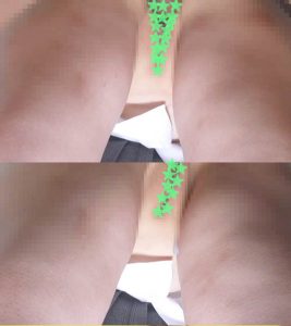 g708803