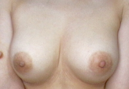 f1794240