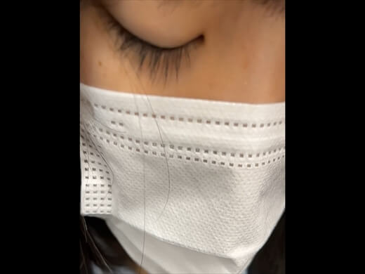 g911852